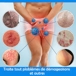 Charger l'image dans la galerie, Private-Solution aux infections et démangeaisons de la peau
